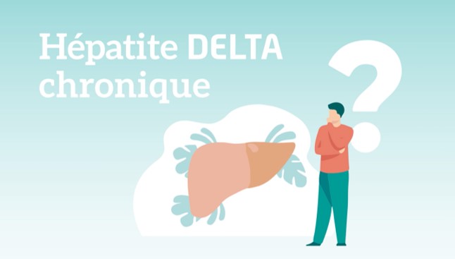 Video_HDV-motion-design